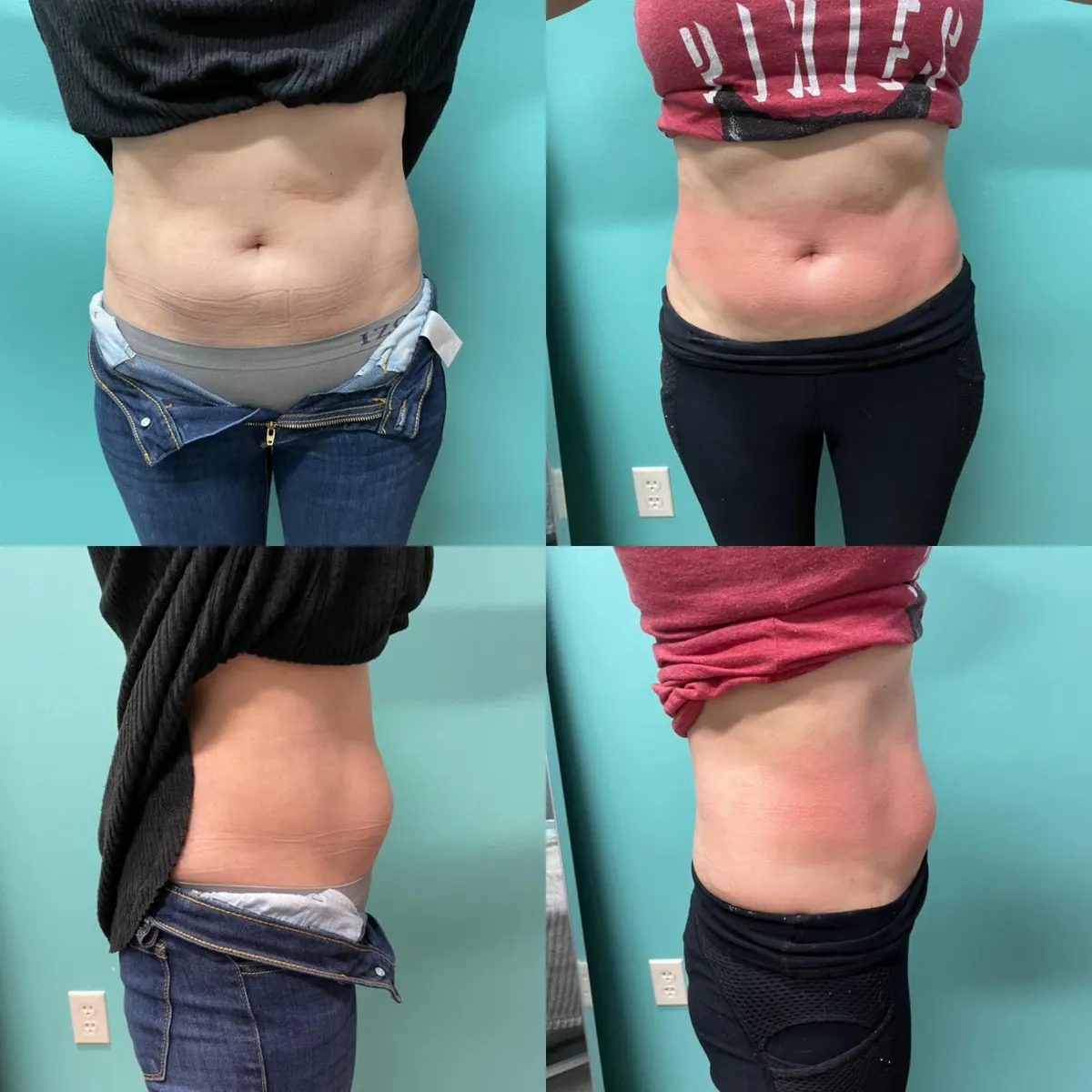Abdomen · Front & Side