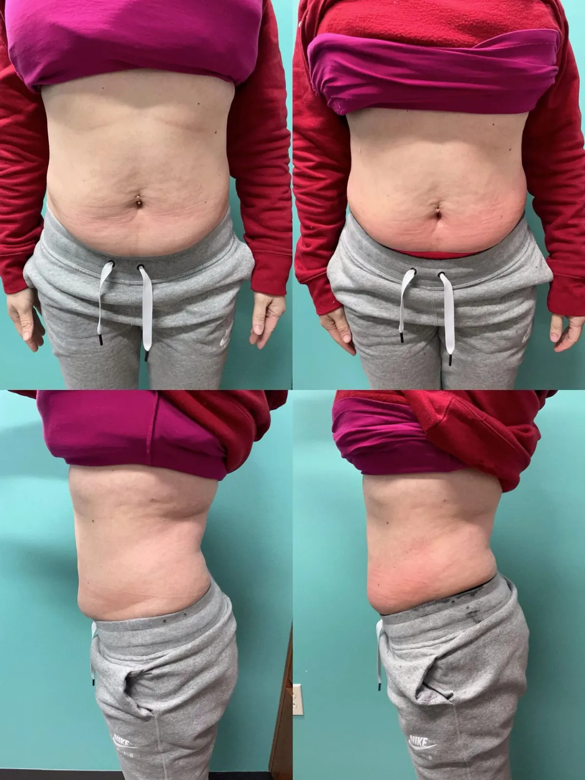 Abdomen · Multi-angle